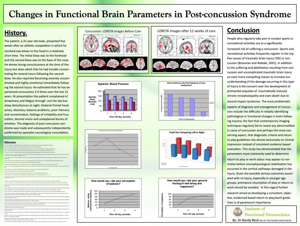 POSTCONCUSSIONSYNDROME The Institute of Functional Neuroscience